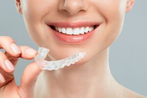 angel aligner vs invisalign wear