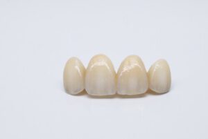 Types of Dental Crowns and Cost front