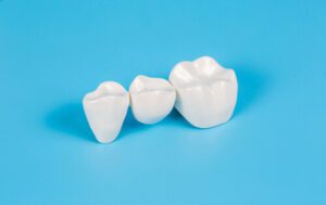 Types of Dental Crowns and Cost procelain